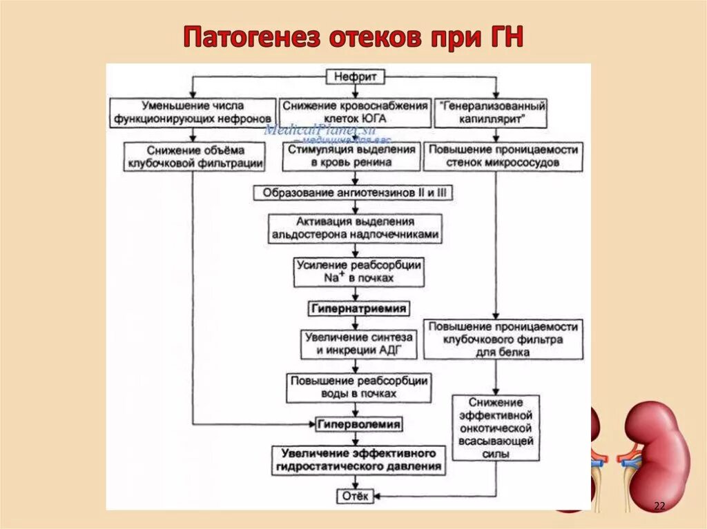 Патогенез воспалительного отека схема. Отеки при гломерулонефрите патогенез. Механизм развития отеков при гломерулонефрите. Механизм развития воспалительного отека. Патогенез почки