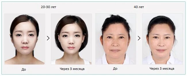 Тест на азиата. Тест на азиата. Бесплодная женщина. Тест на азиата. Фраутест динамика.