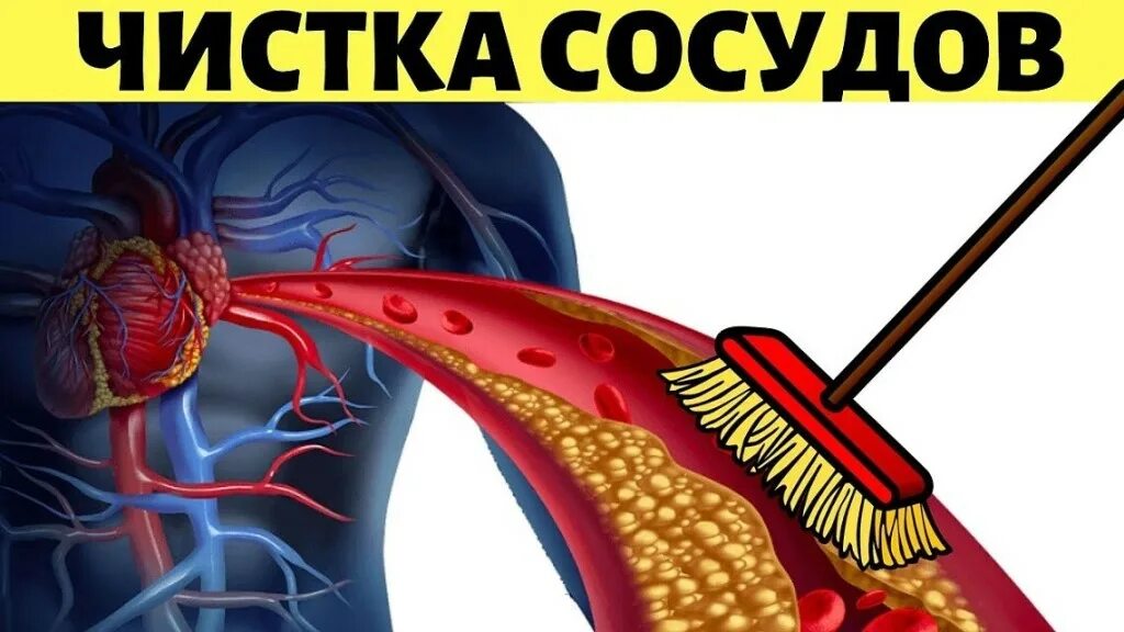 Чистка кровеносных. Чистка артерий и сосудов. очищение сосудов. чистка сосудов от тромбов.
