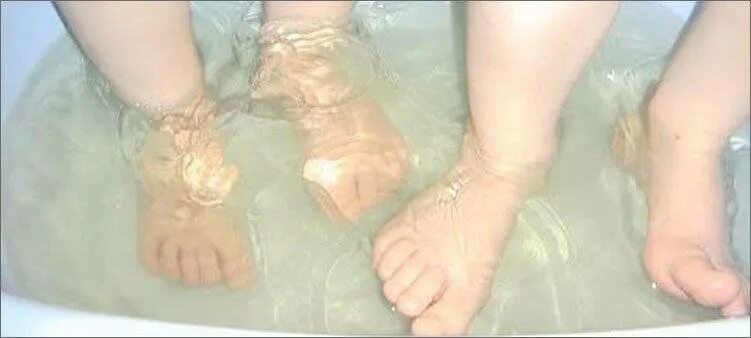 Детские ножки в ванне. Гипергидроз стопы у детей. Ножки новорожденного ребенка холодные. Почему у ребенка влажные ноги. У ребёнка болят стопы ног.