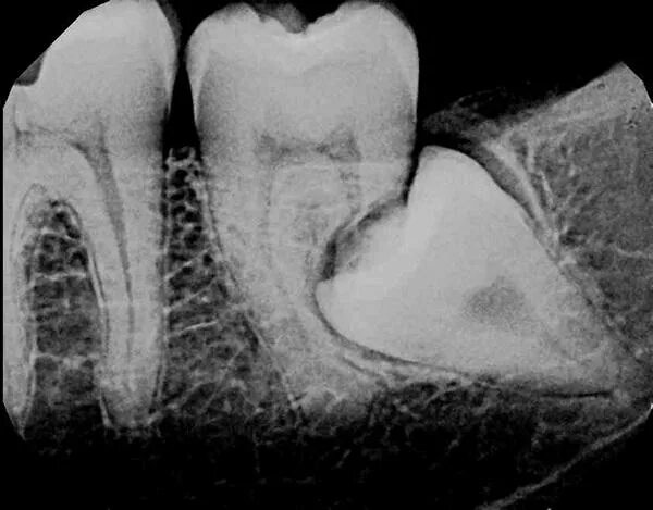 Картинки ONE TOOTH FOOT