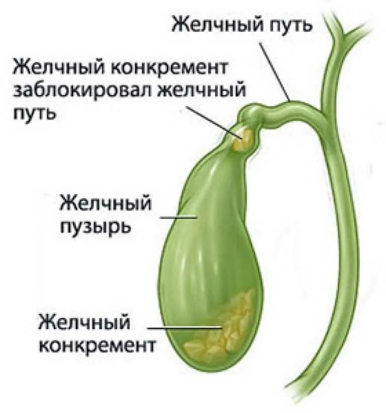 Желчный пузырь гомогенное что значит