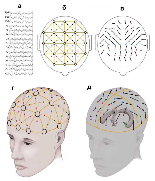 ЭЭГ головного мозга. ЭЭГ система 10-20. ЭЭГ головного мозга шапочка. Шапочка для энцефалографа.