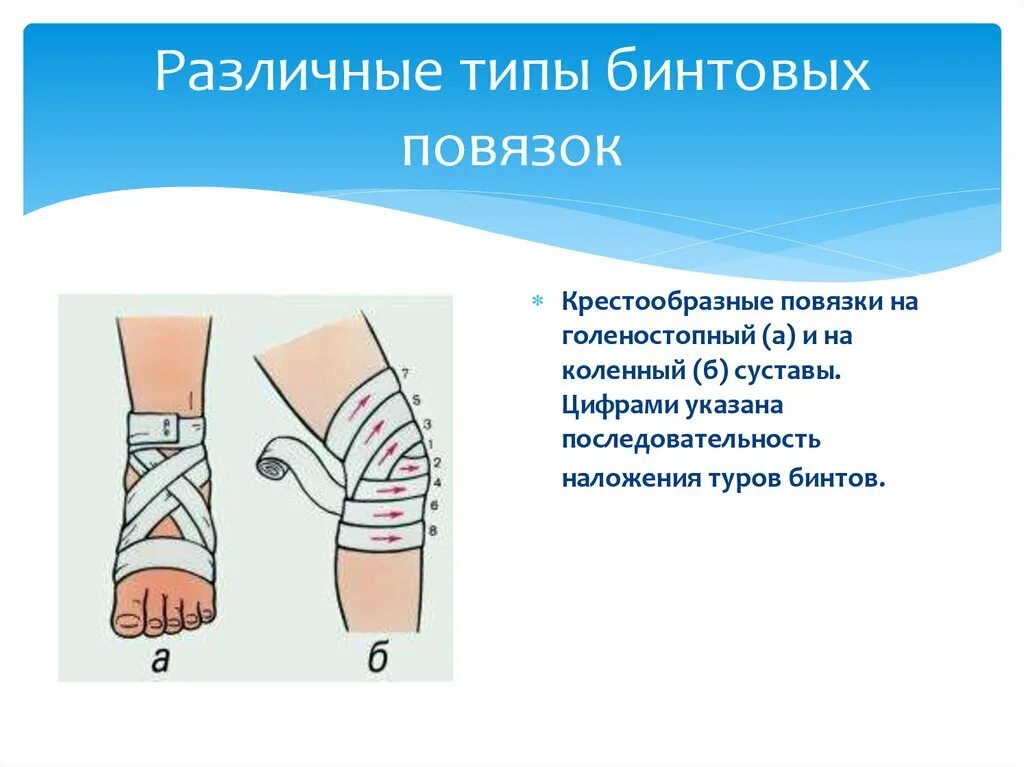 Какая повязка накладывается при повреждении голеностопного сустава. Повязки (правила наложения, виды, схемы). Различные типы бинтовых повязок. Способы наложения бинтовых повязок. Мягкие бинтовые повязки.