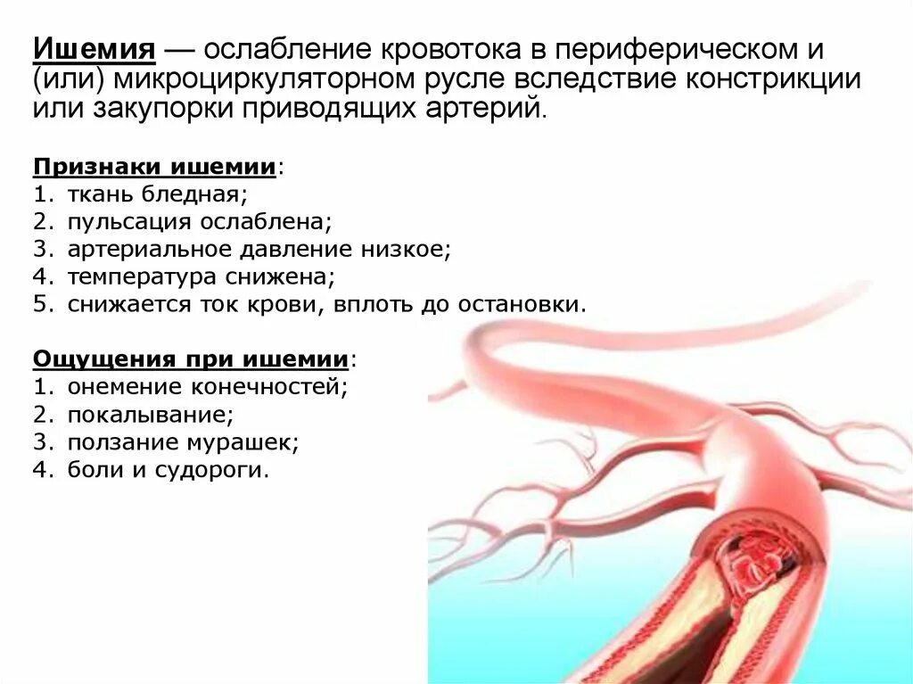 Почему пульсируют артерии