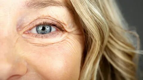 Under eyes