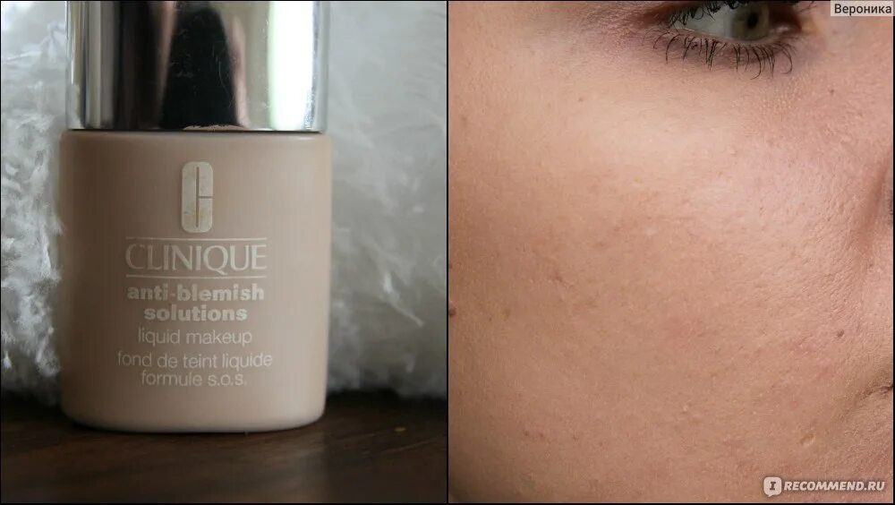 Тон для проблемной кожи. Clinique anti-blemish тональный крем палитра. клиник тоналка для проблемной кожи. clinique anti-blemish solutions тональный крем. clinique тональный крем для проблемной кожи sand 06.