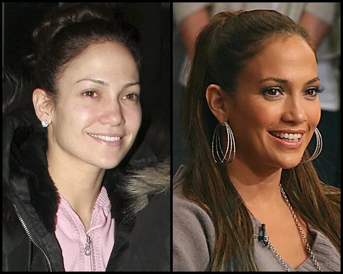 Дженнифер лопес до пластических операций. Дженнифер лопес до и после. Лопес до и после пластики. Дженнифер лопес до пластики в молодости. Дженнифер лопез в молодости.