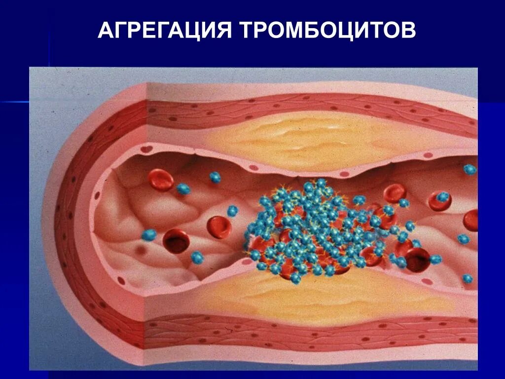 Адф тромбоцитов. Склеивание тромбоцитов. agregatsiya trombotsitob. слипание тромбоцитов.