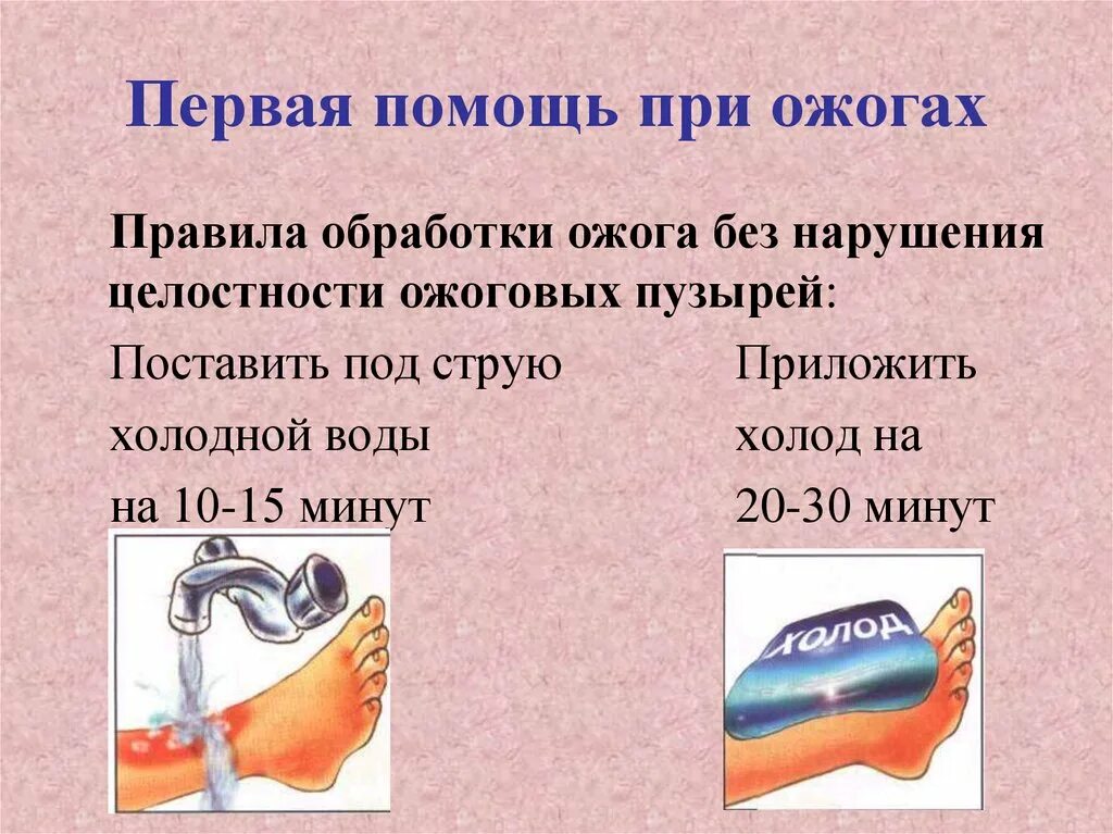 Оказание первой помощи при ожогах. Оказание помощи при ожоге 1 степени. Обработка ожогов водой