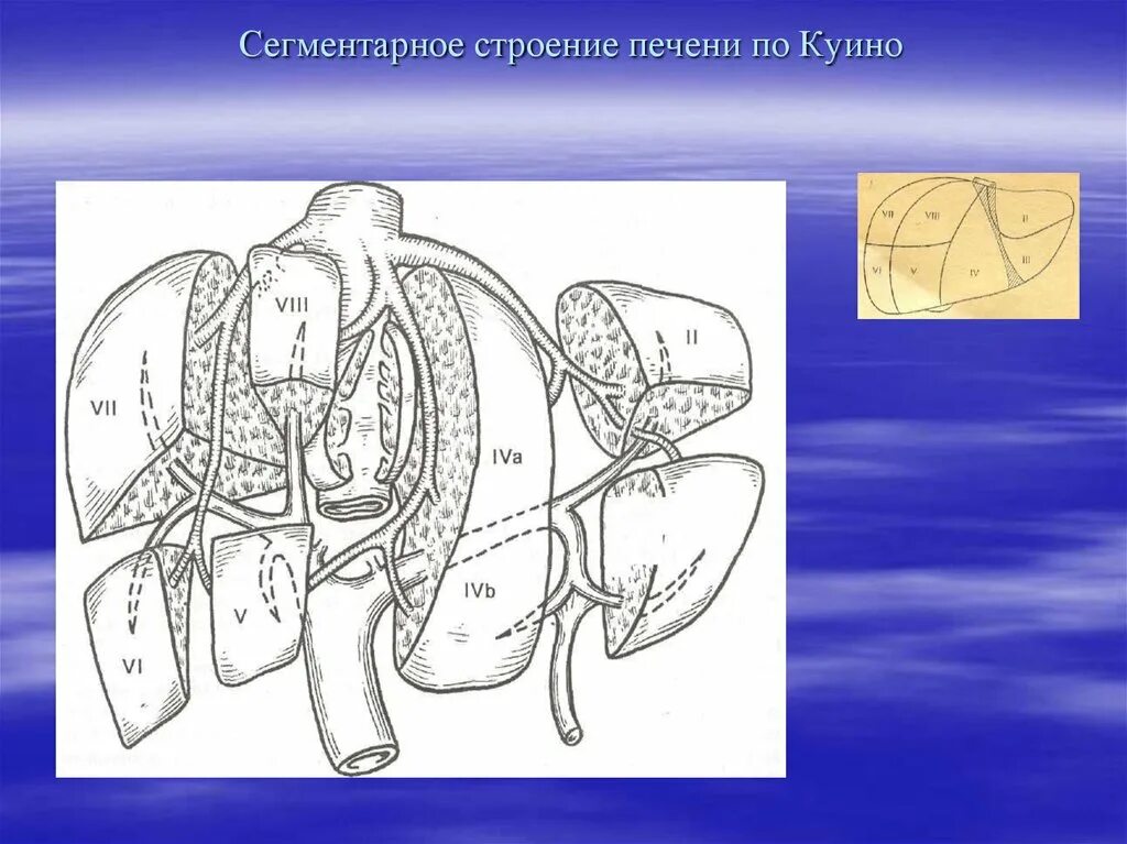 Сегментарное строение печени. Сегментарное строение печени анатомия. схема куино печень. сегменты печени по куино. строение печени по куино.
