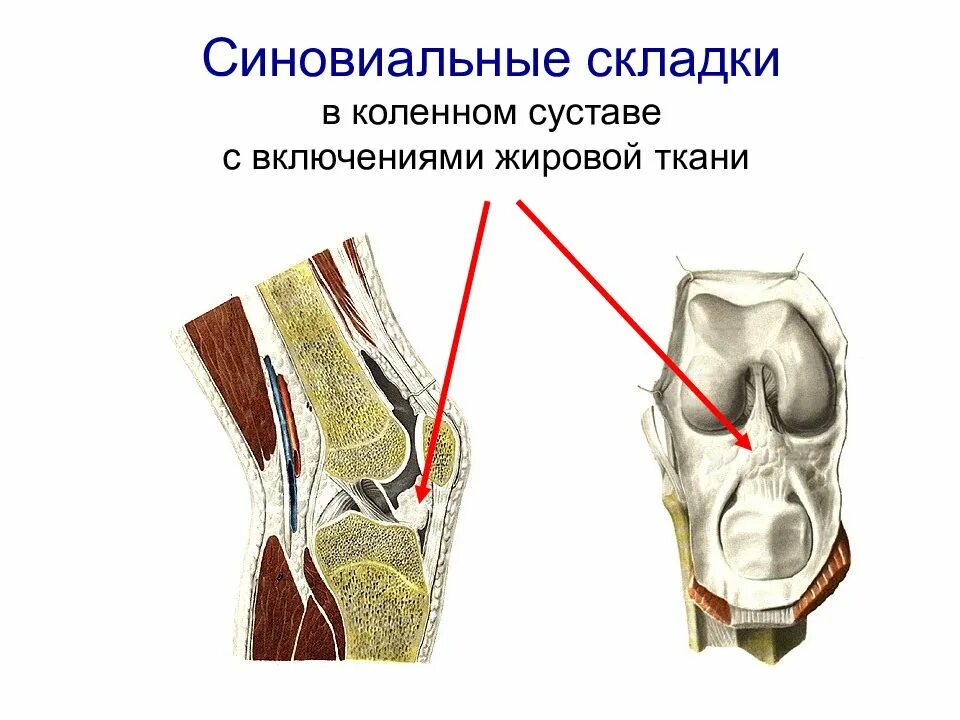 Коленный сустав таблица. Медиопателлярная синовиальная складка. Крыловидные складки коленного сустава анатомия. Складка Гоффа коленного сустава. Гипертрофия медиопателлярной синовиальной складки.