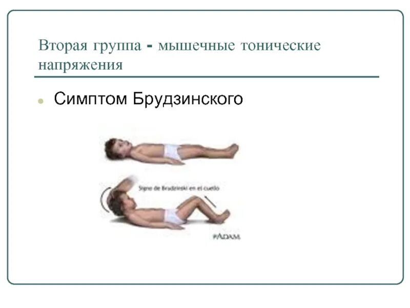 Фазы судорог. Тонические и клонические судороги. клонические и тонические судороги у детей. генерализованные тонико-клонические судороги. эпилепсия клонико тонические судороги.