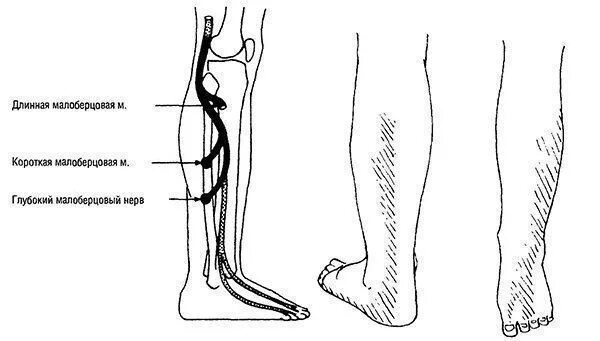 Большеберцовая нейропатия. Поверхностный малоберцовый нерв иннервация. Иннервация малоберцового нерва. Малоберцовый нерв схема. Большеберцовый нерв анатомия.