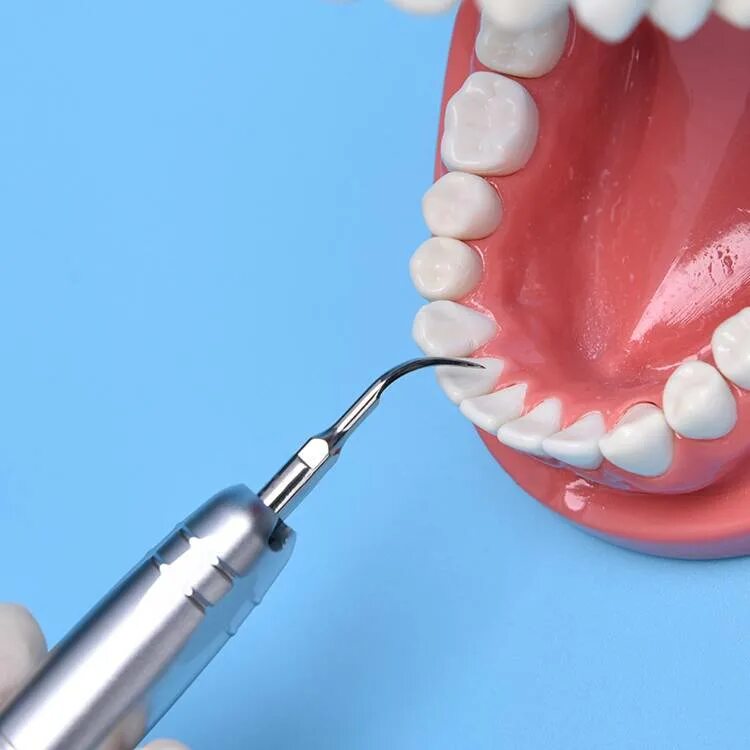 Профессиональная чистка зубов у стоматолога. Профгигиена (ультразвук + Air-Flow). АИР флоу в стоматологии. Профгигиена зубов ультразвуком.