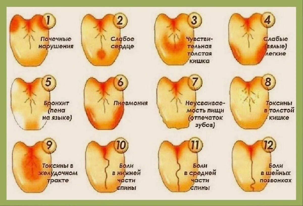 Язык человека определить болезнь. Желучный налет на языке.