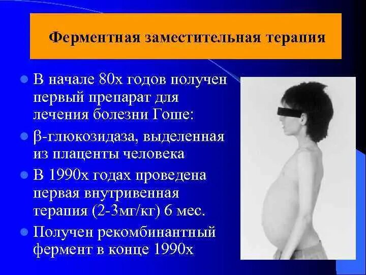 Болезнь гоше презентация. Болезни накопления лизосом. Болезнь гоше клинические проявления. Болезнь гоше препараты. Болезнь гоше патологическая анатомия.