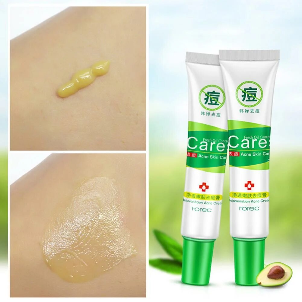 Красивая двушка с прыщами. Биоаква крем от прыщей. Корейское лицо. Cares acne skin care. Cares acne skin care.