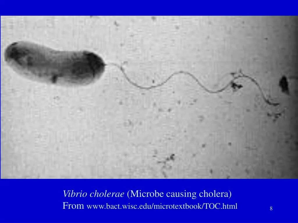 Организм трутовик окаймленный холерный вибрион. Vibrio cholerae микроскопия. Холерный вибрион микробиология. Возбудитель холеры под микроскопом.