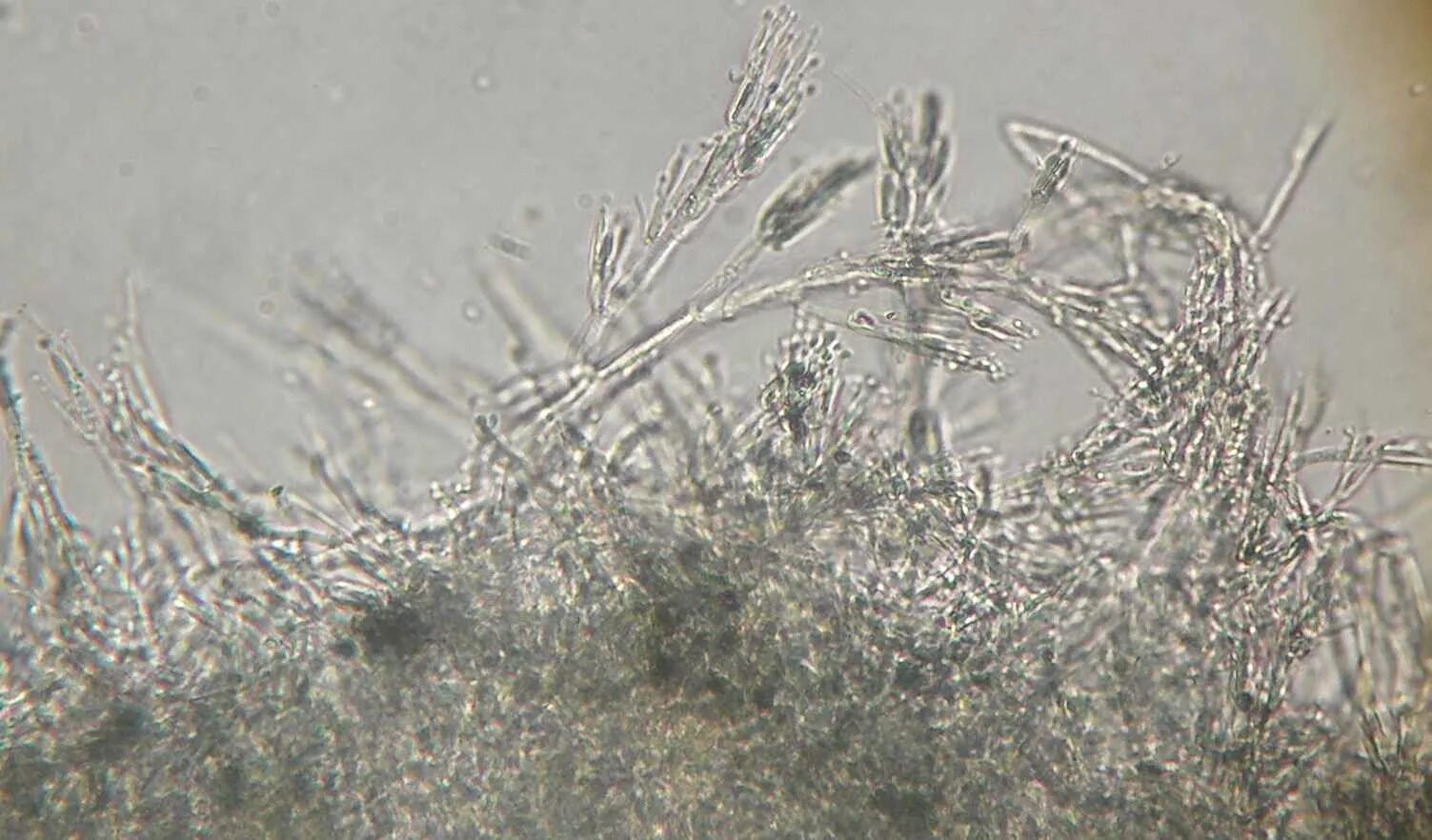 Пеницилл под микроскопом. Плесень penicillium candidum. пеницилл микроскопия. пеницилл микроскоп. мицелий пеницилла под микроскопом.