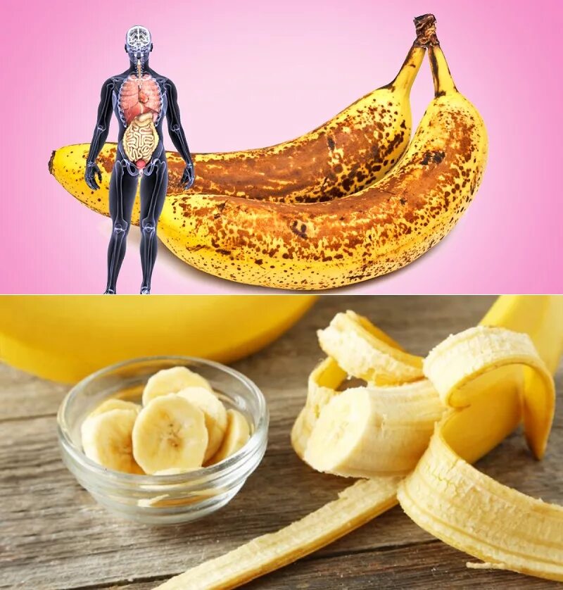 Что полезного в бананах. Чем полезен банан. Банан полезные качества для организма человека. Полезные свойства банана.