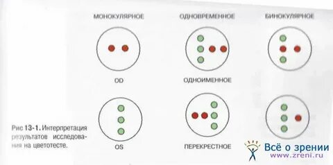 Бинокулярное зрение лечение