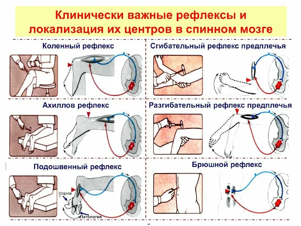 Как проверить рефлексы. Клинически важные спинальные рефлексы физиология. Методика исследования сухожильных рефлексов. Сухожильные рефлексы неврология. Клинически важные спинальные рефлексы у человека.