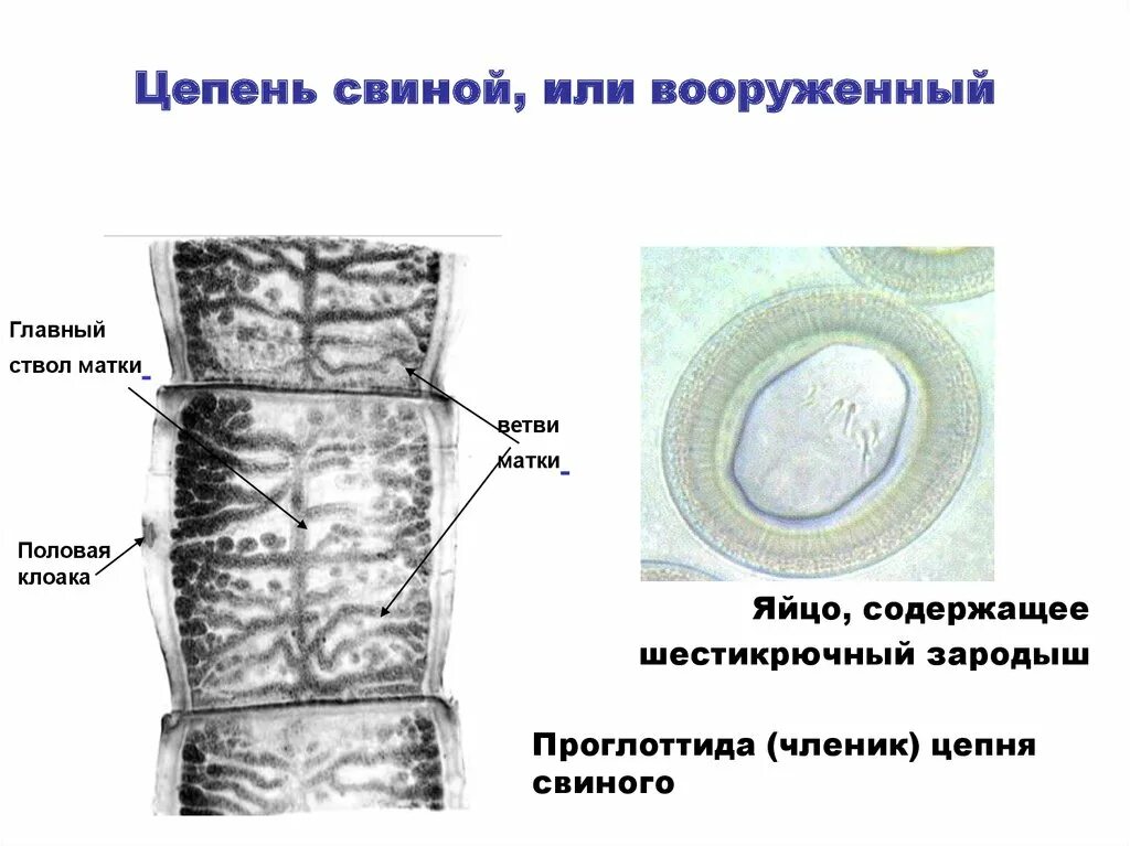 Яйца свиного цепня микроскоп. Строение яйца бычьего цепня. Яйца онкосферы тениид. Бычий свиной и карликовый цепень.