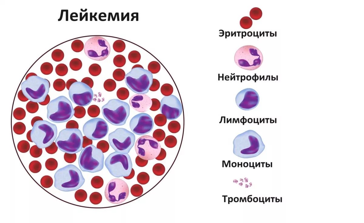 Болезни крови у мужчин