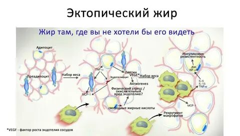 Там жира