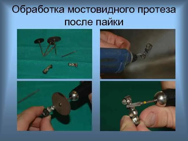Обработка шлифовка полировка. Обработка мостовидного протеза. парного мостовидного протеза. полировка цельнолитого мостовидного протеза. пайка мостовидного протеза.