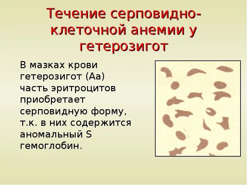 Серповидноклеточная анемия гетерозиготы. Наследование серповидноклеточной анемии. Эритроциты при серповидноклеточной анемии. Тип наследования серповидно-клеточной анемии.