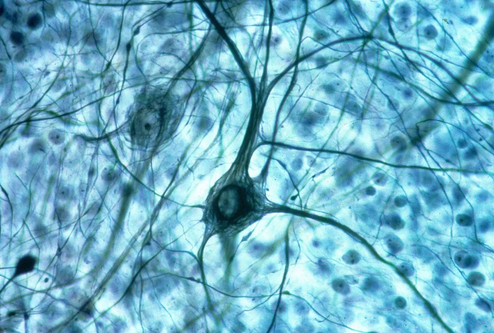 Стволовые клетки микрофотография. Клетка нейрона. Аксон нейрона микрофотография. Нервная ткань микрофотография. Какие клетки живые на препарате