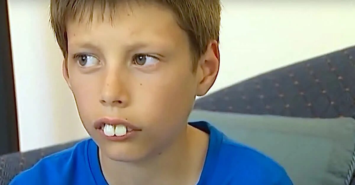 Глупые подростки. Эван Хилл 2022. Человек с самыми большими зубами. Мальчик с большими зубами.