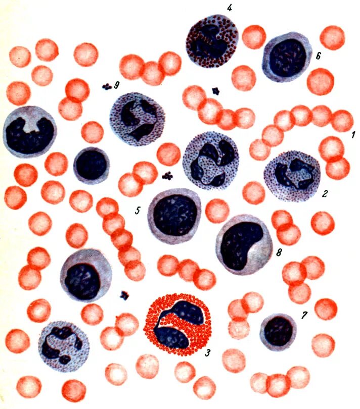 Культивирование клеток крови. Мазок крови человека лейкоциты. Нейтрофильный лейкоцитоз микрофотография. Мазок крови гистология препарат. Клетки крови микроскопия.