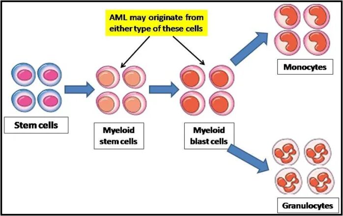 Aml проверка cryptozen. Acute Leukemia. Acute Leukemia classification. Acute myeloid Leukemia. AML.