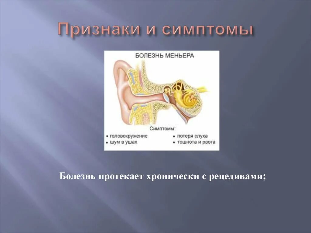 Болезни внутреннего уха Меньера. Болезнь Меньера гидропс. Признаки болезни Меньера. Болезнь Меньера тугоухость.