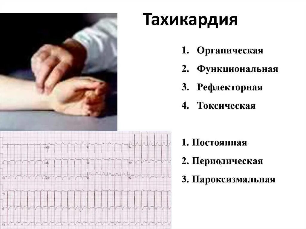 Повышенное сердцебиение после