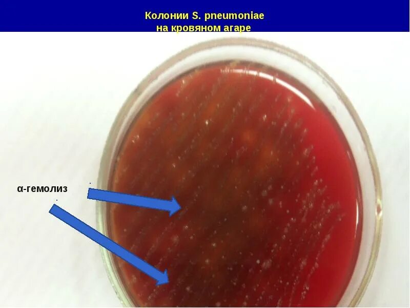 Бета гемолиз на кровяном агаре. Streptococcus viridans кровяной агар. Бета гемолиз на кровяном агаре. Альфа гемолиз на кровяном агаре. Кровяной агар гемолиз.