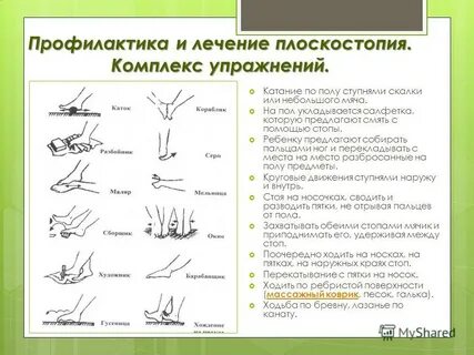 Упражнения при поперечном плоскостопии у взрослых
