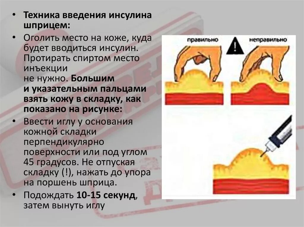 Инъекция инсулина алгоритм. Подкожное Введение инсулина алгоритм. Техника введения инсулина подкожно шприц ручкой. Продемонстрируйте технику введения инсулина. Алгоритм инъекции инсулина подкожно.