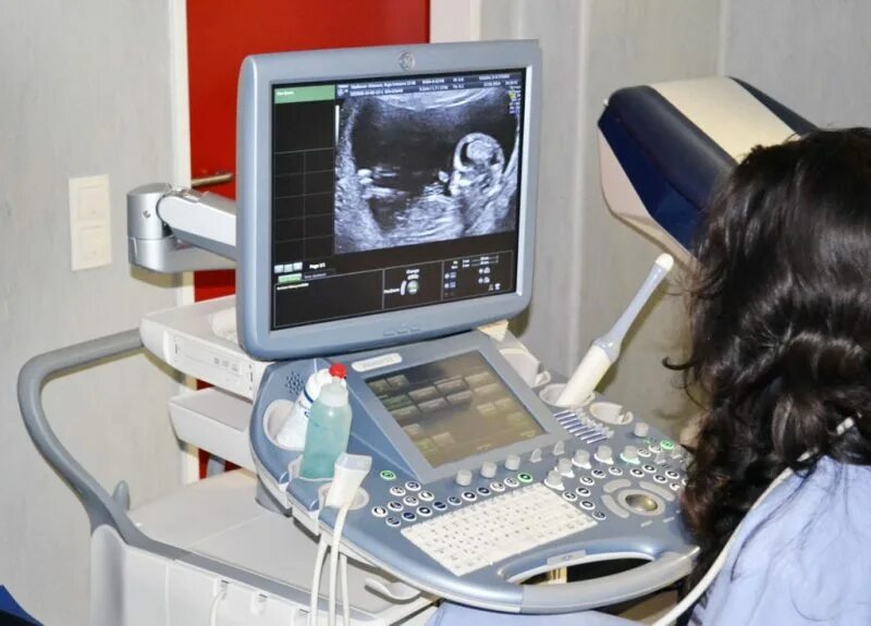 Узи грудничку. Скрининг узи сердца. Узи 13 недель беременности скрининговое. Эхокардиография протокол узи. Венозный проток pi 1 скрининг норма.