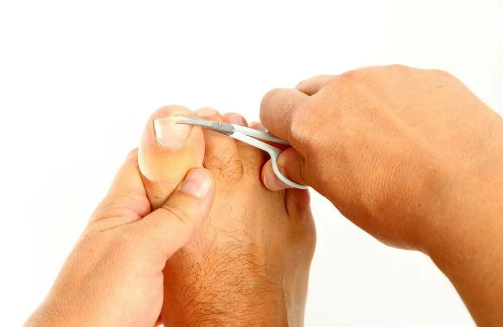 Подстричь ногти старому. Правильная стрижка ногтей на ногах. Подстригание ногтей на ногах. Правильно подстриженные ногти на ногах.