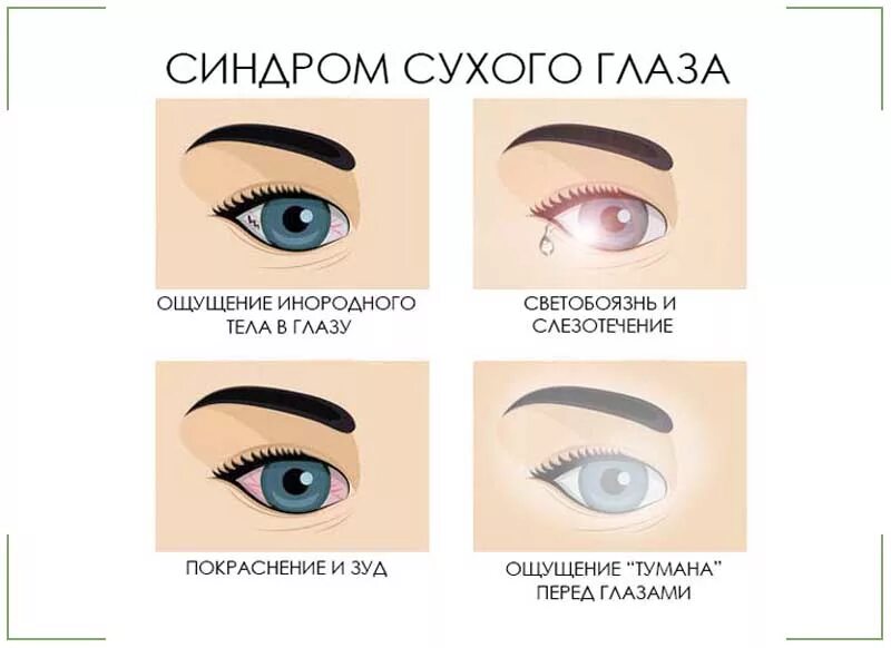 Песок в глазах ощущение причины и лечение
