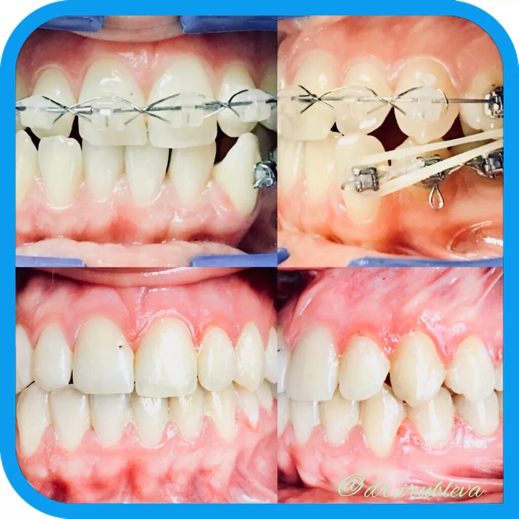 Ортодонт л. Бут андрей ортоцентр. Ортодонт л. Стоматология ортодонт центр  омск. Ортодонт л.
