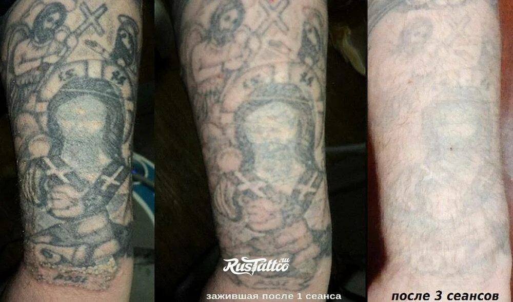Через сколько после тату можно в баню. Через сколько после тату можно в баню. Где можно набить тату. Перекрытие тату на спине. Тату до и после заживления.