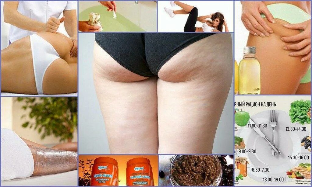 Занятие от целлюлита в домашних. Против целлюлита на бедрах и ягодицах. Обёртывание для похудения антицеллюлитный. Обёртывание для похудения. Массаж от целлюлита на ляшках.