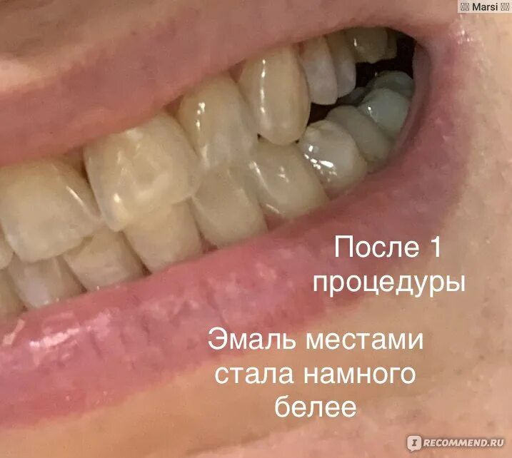 Женщина на берегу моря. Намного белее. Намного белее. Намного белее. Volkswagen много машин.