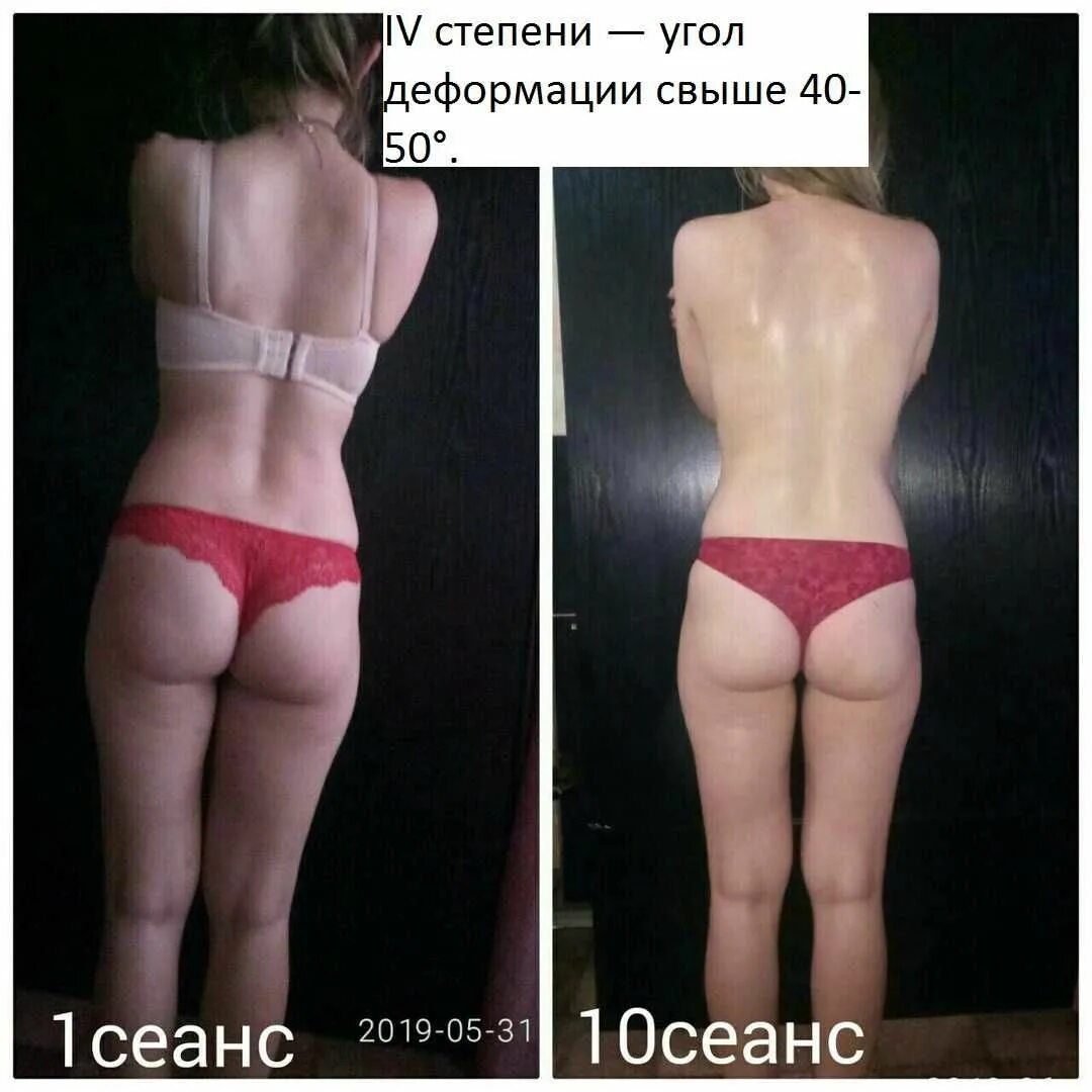 Массаж донецк днр. Долой целлюлит. долой целлюлит программы. массаж в днр.
