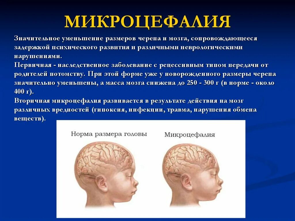 Синекизии это. Понятие угрозы. Опорно двигательная система млекопитающих функции. Клонусы и синкинезии это. Боль в суставах скелет.